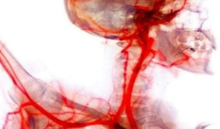 Jesus veio por água e sangue